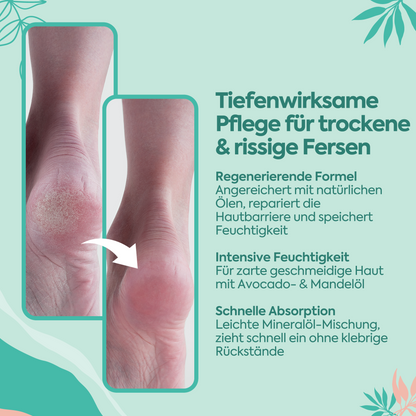 Perfekte Fuß- und Fersenpflege gegen Risse – 100 ml
