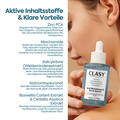 Anti-Mitesser & Akne Serum – 50 ml