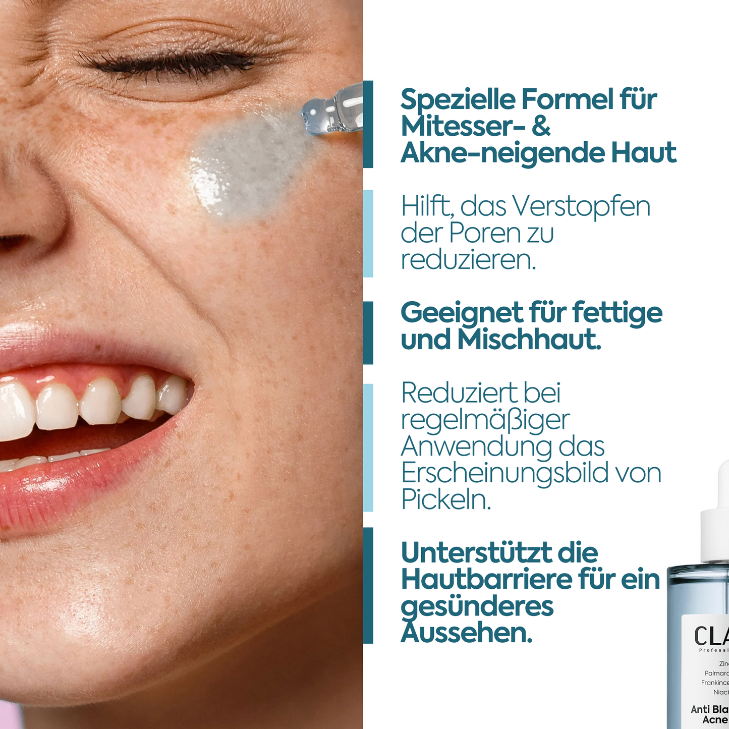 Anti-Mitesser & Akne Serum – 50 ml
