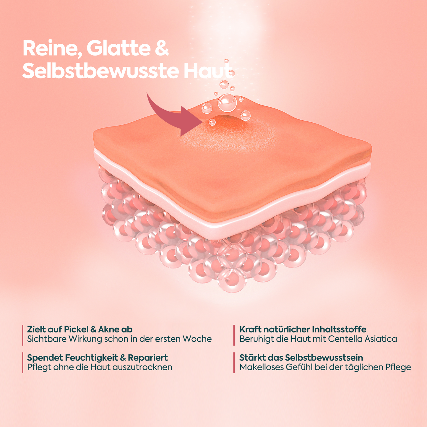 Perfekte Wirkung gegen Akne & Pickel – FACEUPSKIN® für unreine Haut 40 ml