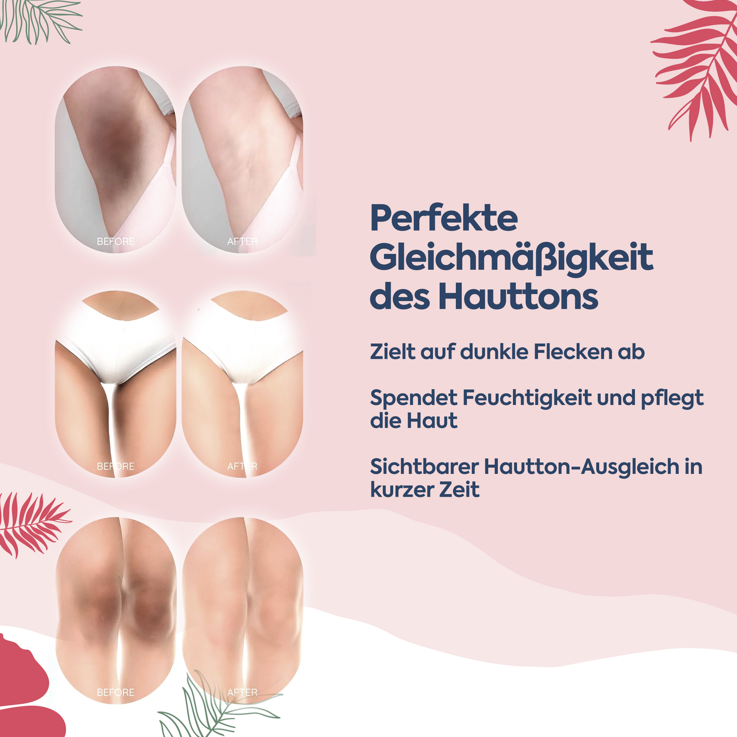Anti-Flecken & Hautton-Ausgleichende Albanische Formel – Pigment Korrektur Creme 100 ml