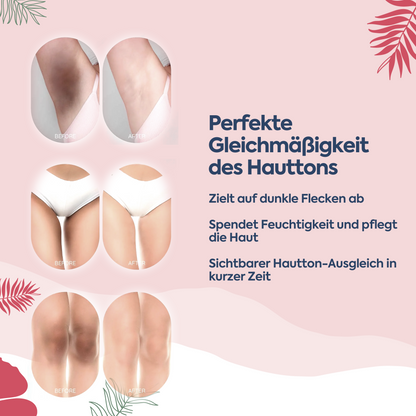 Anti-Flecken & Hautton-Ausgleichende Albanische Formel – Pigment Korrektur Creme 100 ml