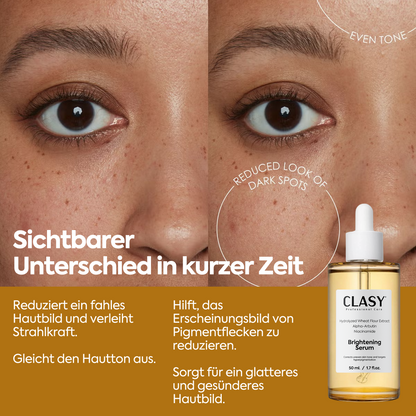 Aufhellendes & Fleckenminderndes Serum – 50 ml
