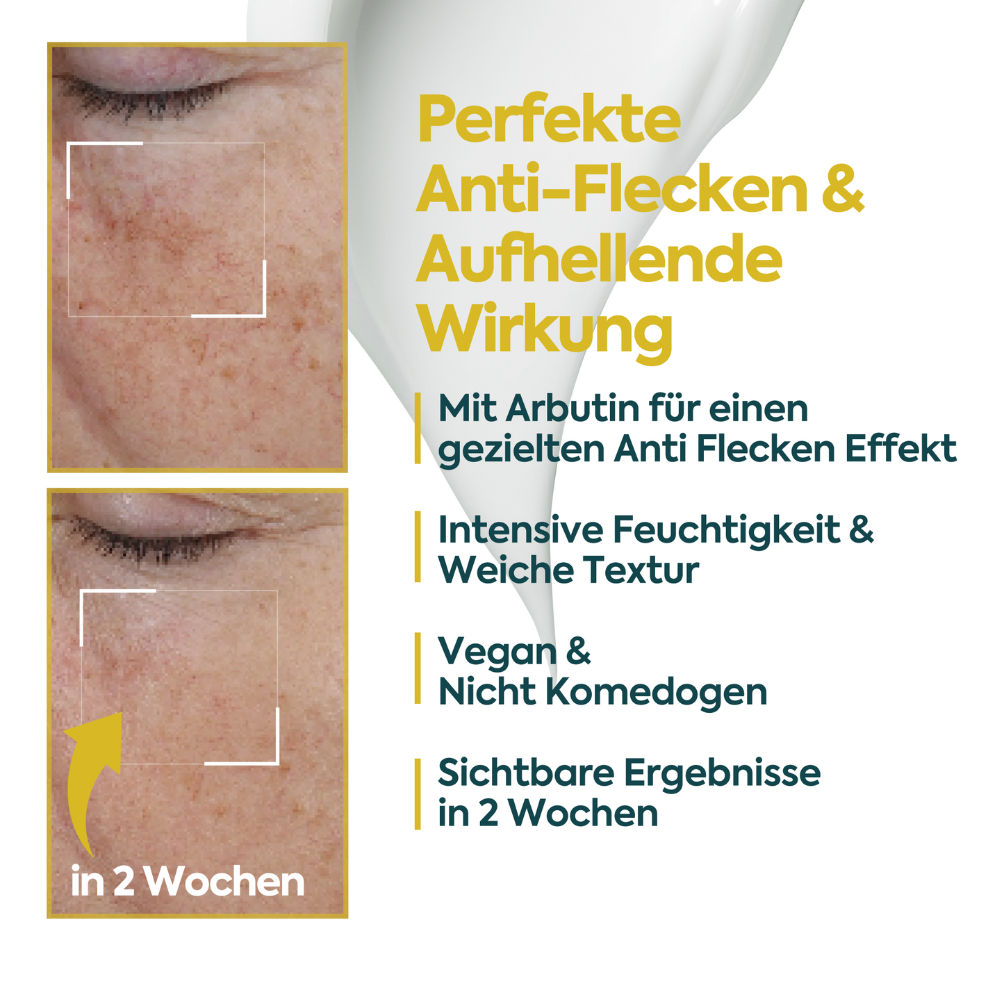 Aufhellende Anti-Flecken-Creme – FACEUPSKIN® Spot Cream 40 ml