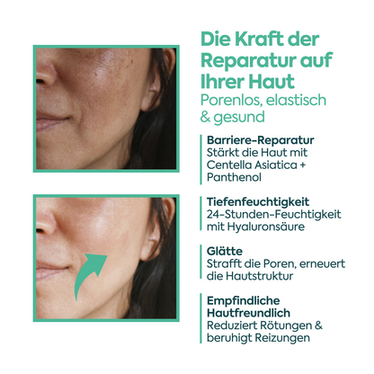 Perfekte Hautregenerierende Creme – FACEUPSKIN® Repair Cream 40 ml