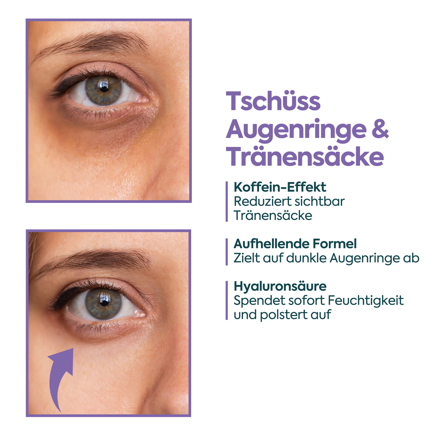 Augencreme gegen Tränensäcke & Augenringe – FACEUPSKIN® Energy & Hydration 40 ml