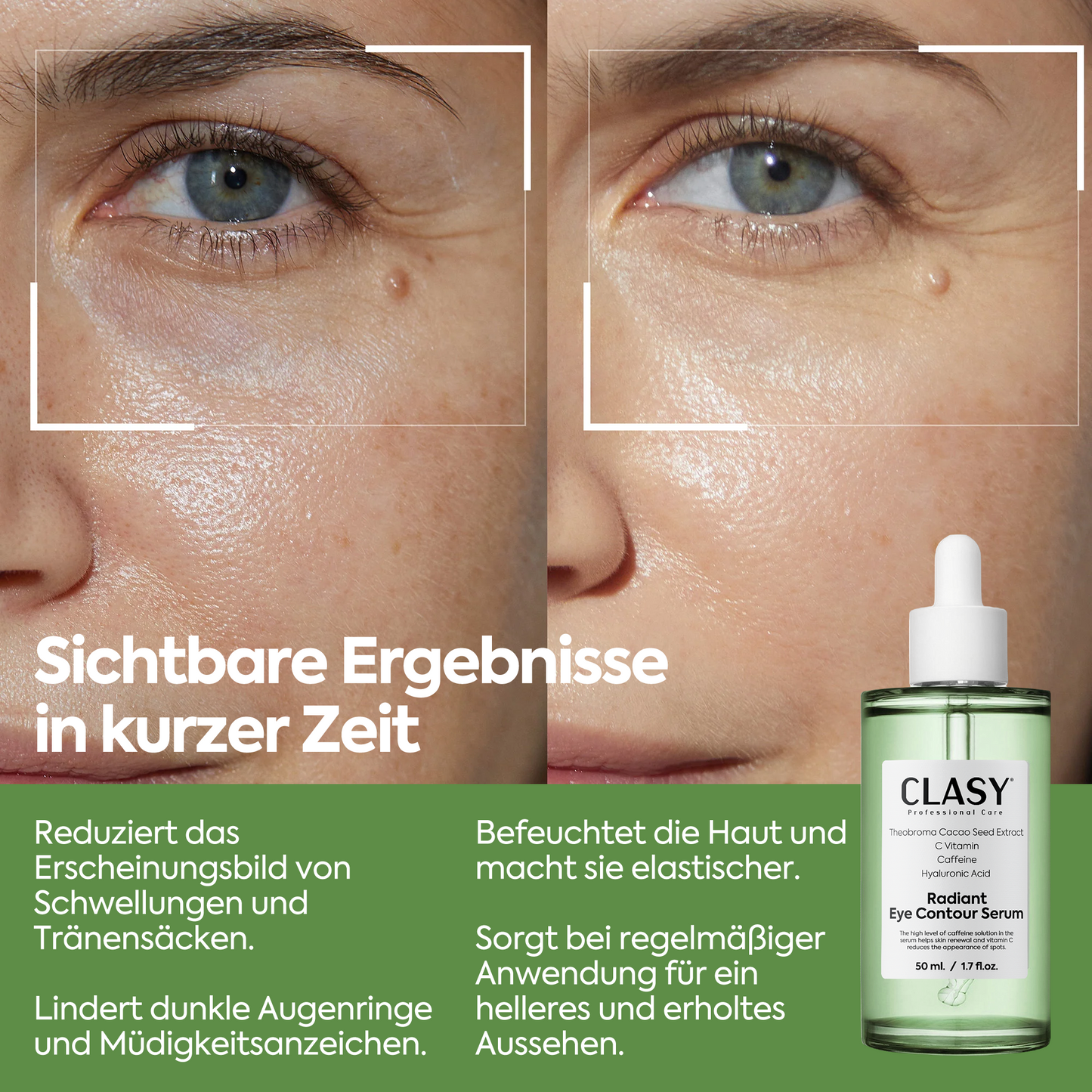 Augenkontur-Serum gegen Tränensäcke – Radiant Eye Contour Serum 50ml