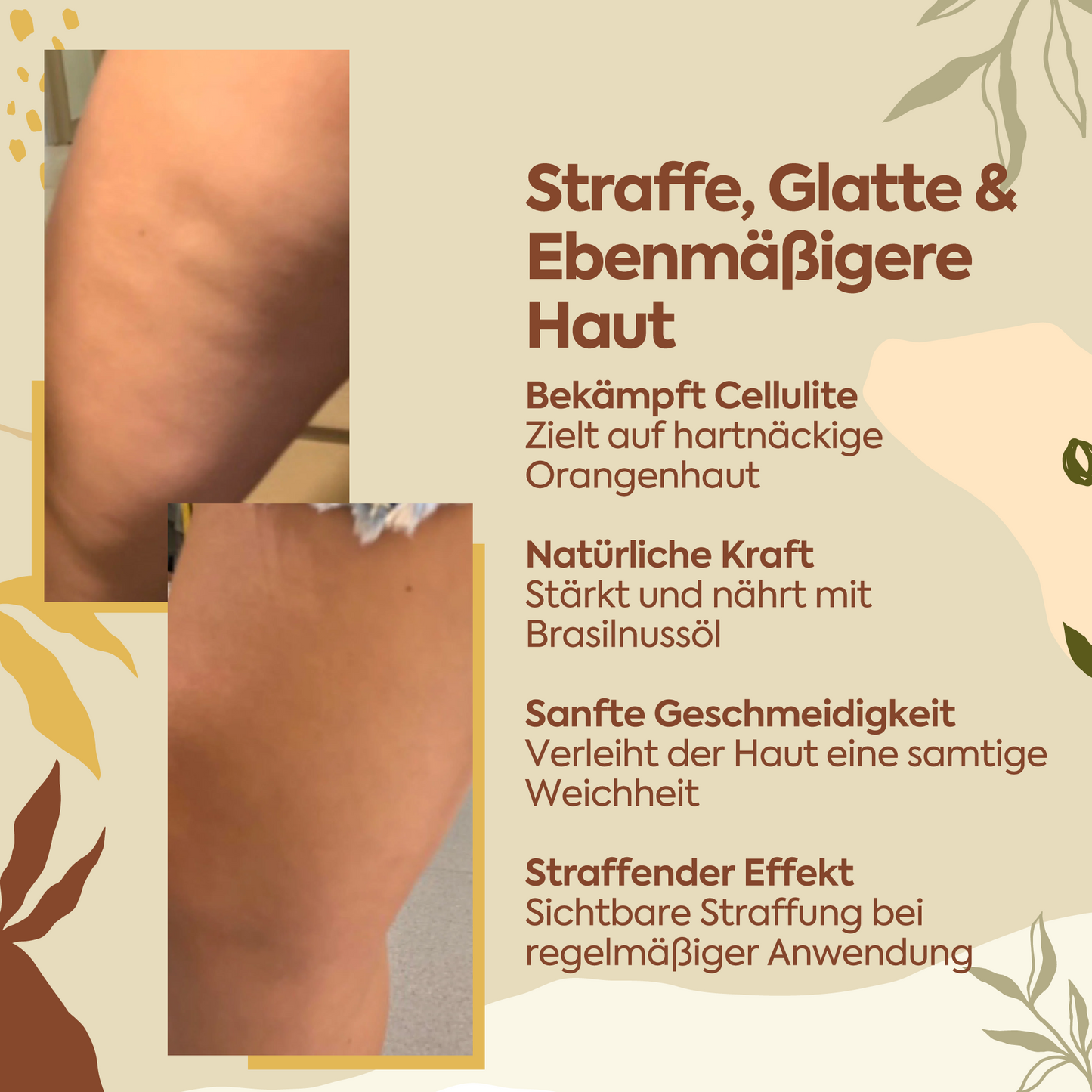 Perfekter Schutz gegen Cellulite – 100 ml