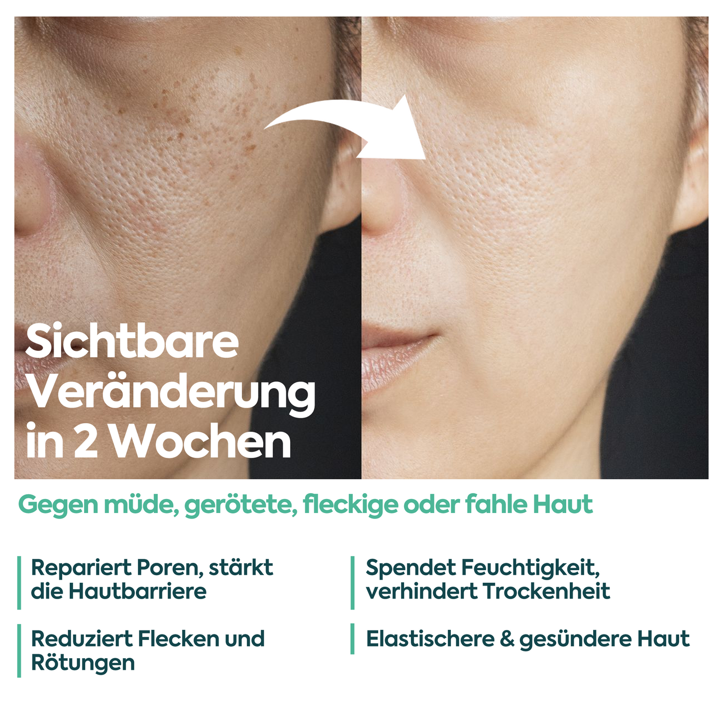 Perfekte Hautregenerierende Creme – FACEUPSKIN® Repair Cream 40 ml