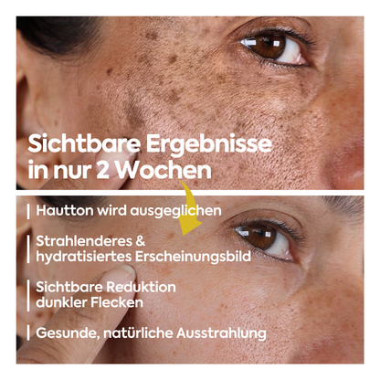Aufhellende Anti-Flecken-Creme – FACEUPSKIN® Spot Cream 40 ml