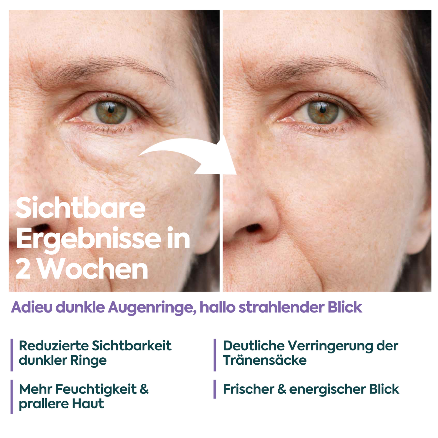 Augencreme gegen Tränensäcke & Augenringe – FACEUPSKIN® Energy & Hydration 40 ml