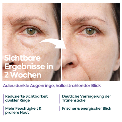Augencreme gegen Tränensäcke & Augenringe – FACEUPSKIN® Energy & Hydration 40 ml