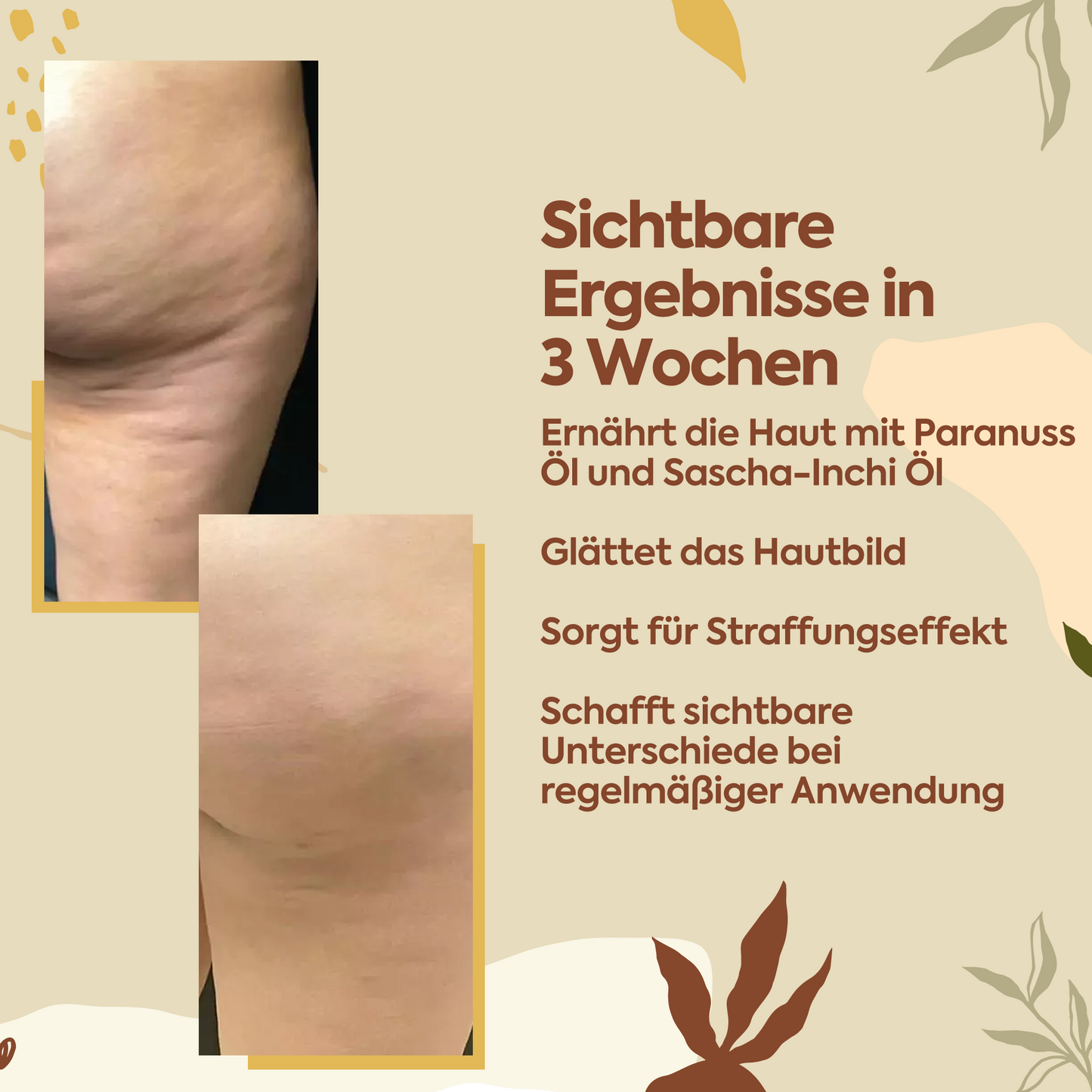 Perfekter Schutz gegen Cellulite – 100 ml