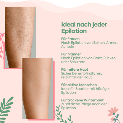 Haarreduzierende Pflege nach der Epilation – Bye-Bye Hairs 100 ml