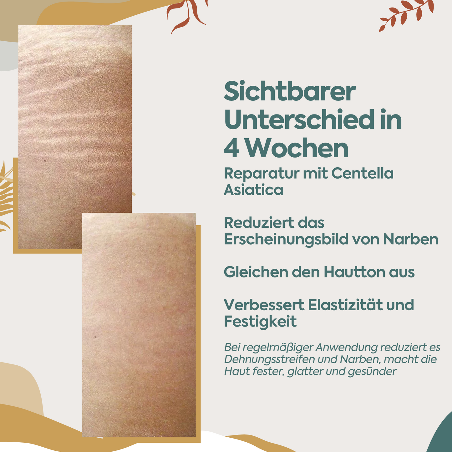 Perfekte Regeneration gegen Narben & Dehnungsstreifen – 100 ml