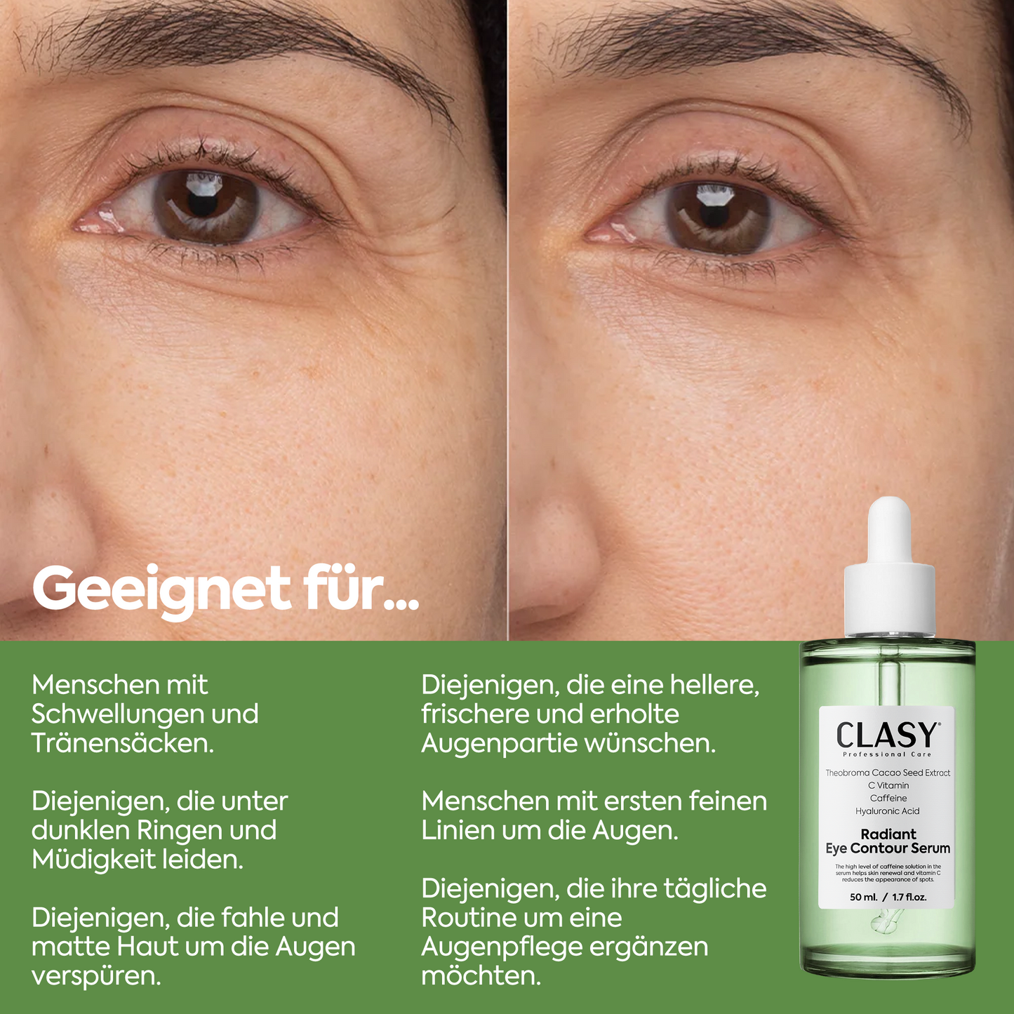 Augenkontur-Serum gegen Tränensäcke – Radiant Eye Contour Serum 50ml