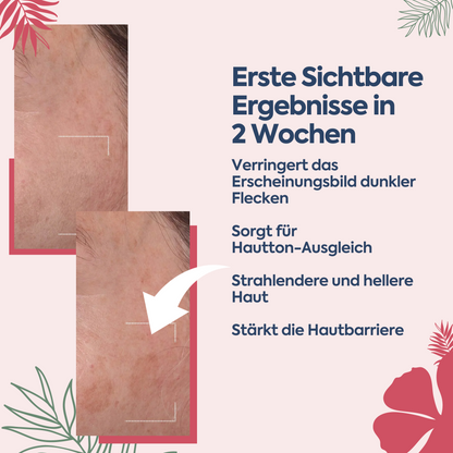 Anti-Flecken & Hautton-Ausgleichende Albanische Formel – Pigment Korrektur Creme 100 ml