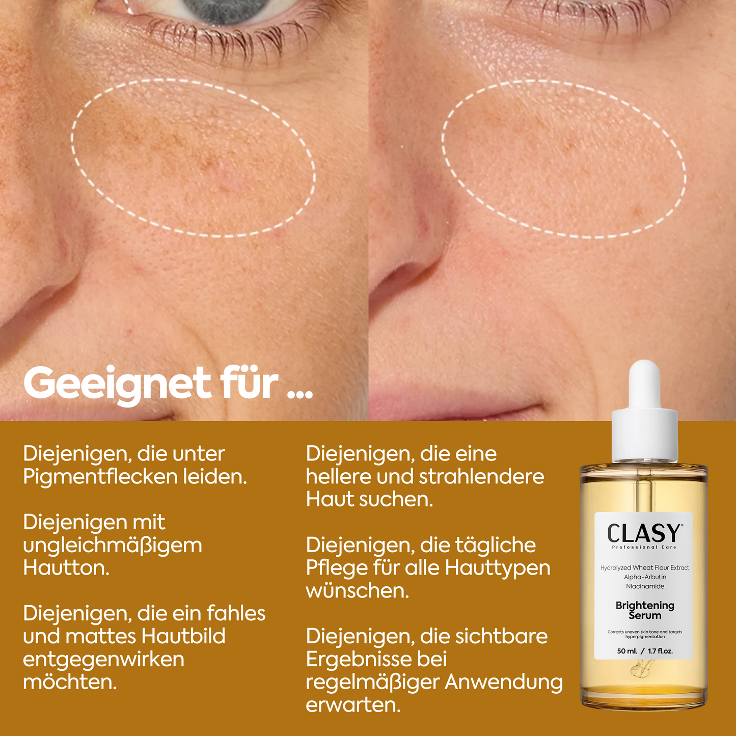 Aufhellendes & Fleckenminderndes Serum – 50 ml